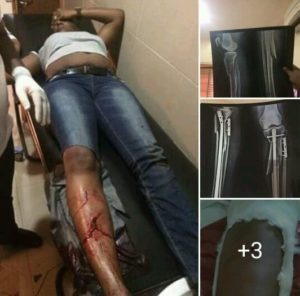 ivie-edobor-zenith-bank1